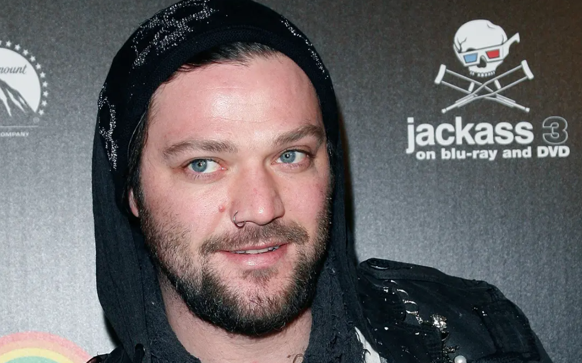 Kórházba került, az életéért küzd a Jackass sztárja, Bam Margera