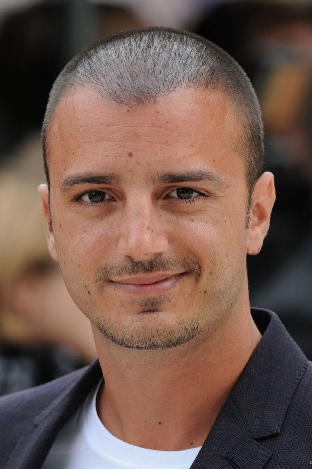 Perche Nicolas Vaporidis Ha Perso I Capelli